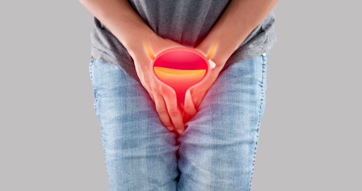 incontinence urinaire